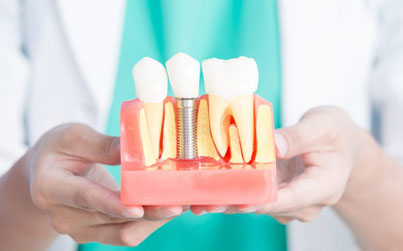 Dental Model
