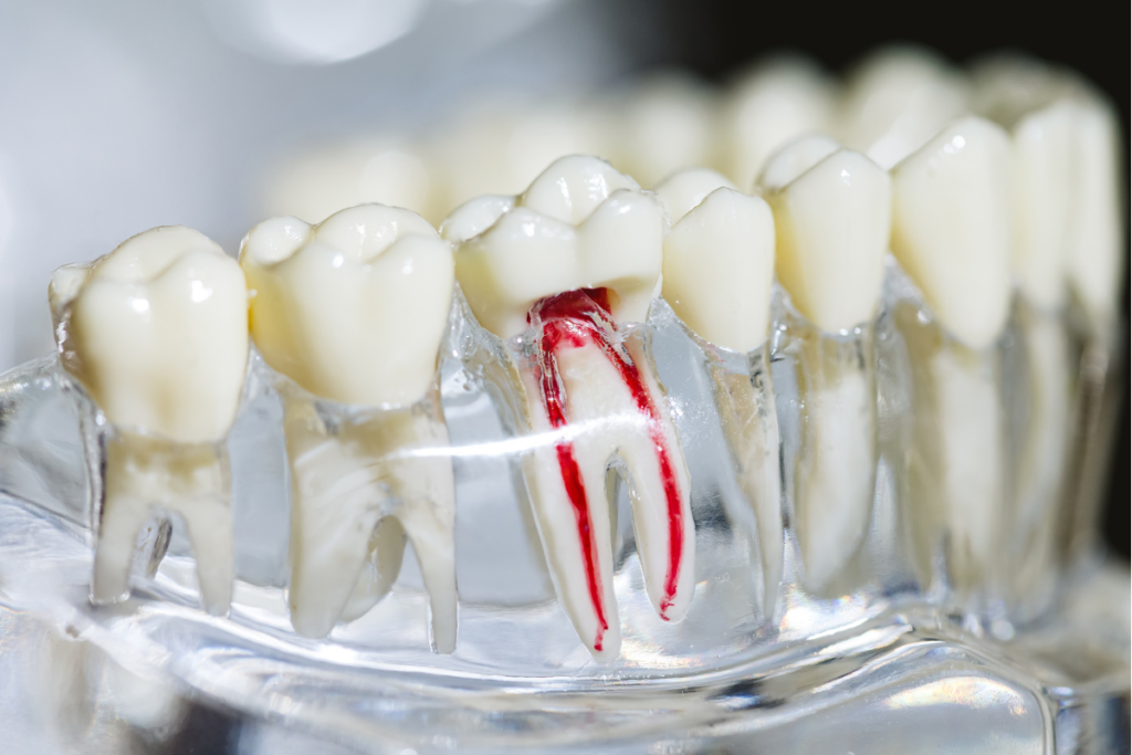 Is Root Canal Treatment as Scary as You Think?