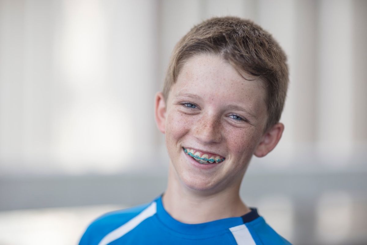 teeth whitening in Camp Springs