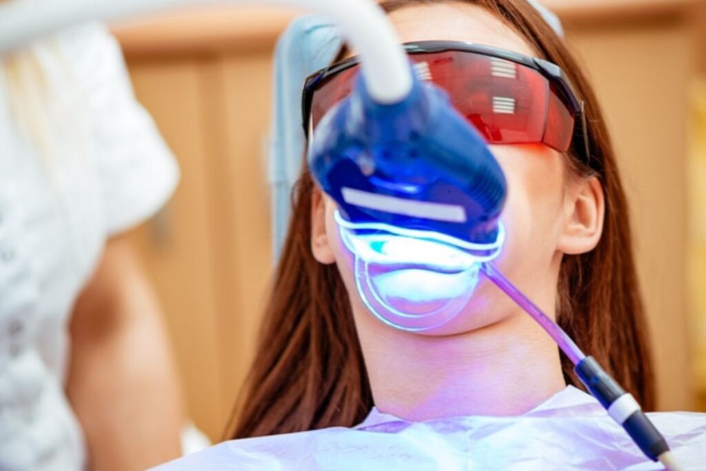 teeth whitening camp springs