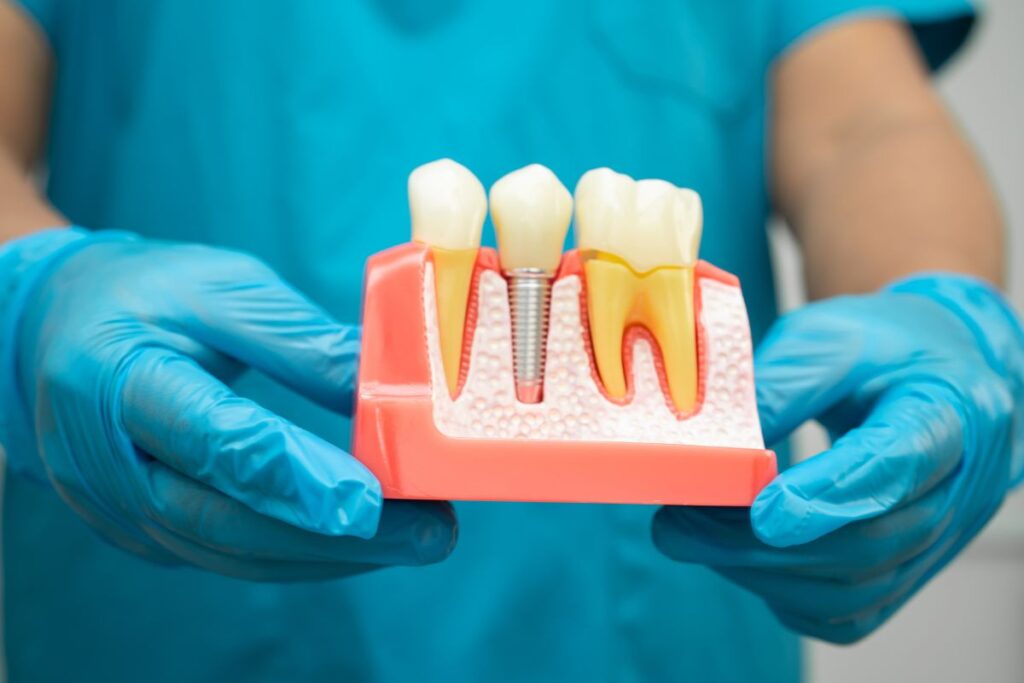 Dentist in blue gloves holding dental implant model showing tooth structure and restoration options.