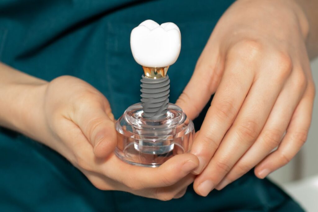 Trust Dental Implants for Long-Term Results